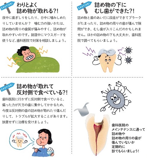 詰め物や周りの歯、傷んでいませんか？