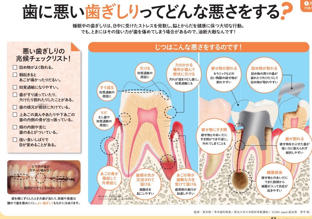 歯ぎしりの怖さ。