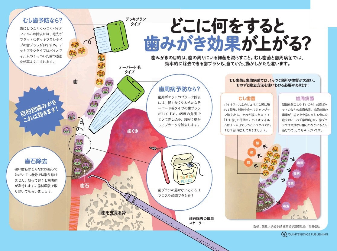 歯磨きの正しいやり方とは？