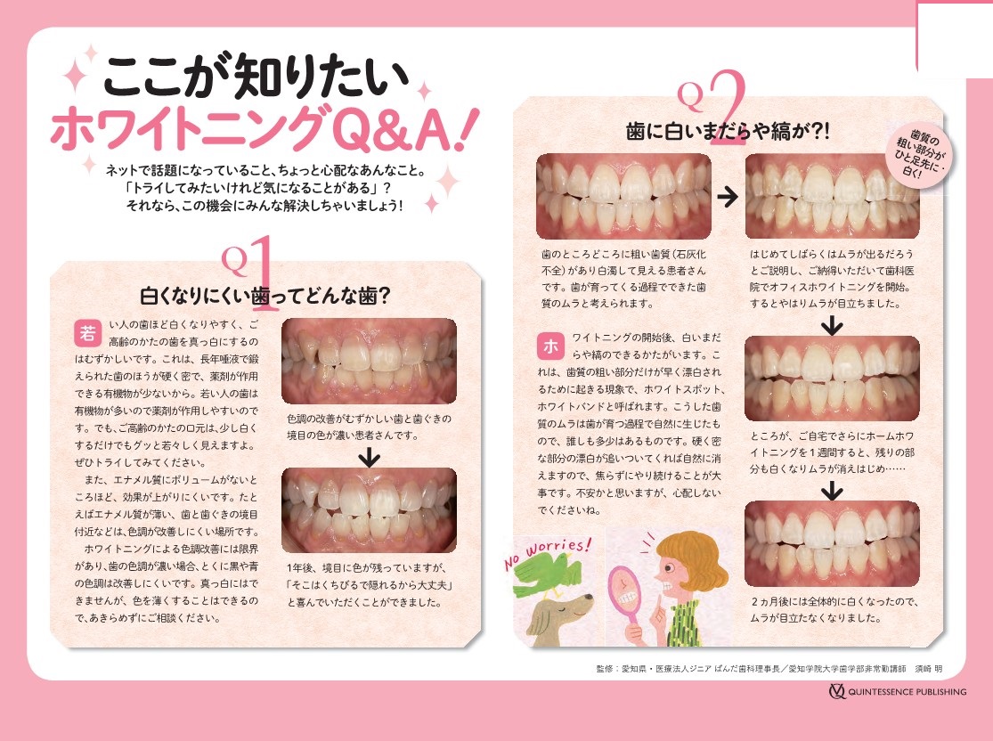 最近人気の高いホワイトニング！！