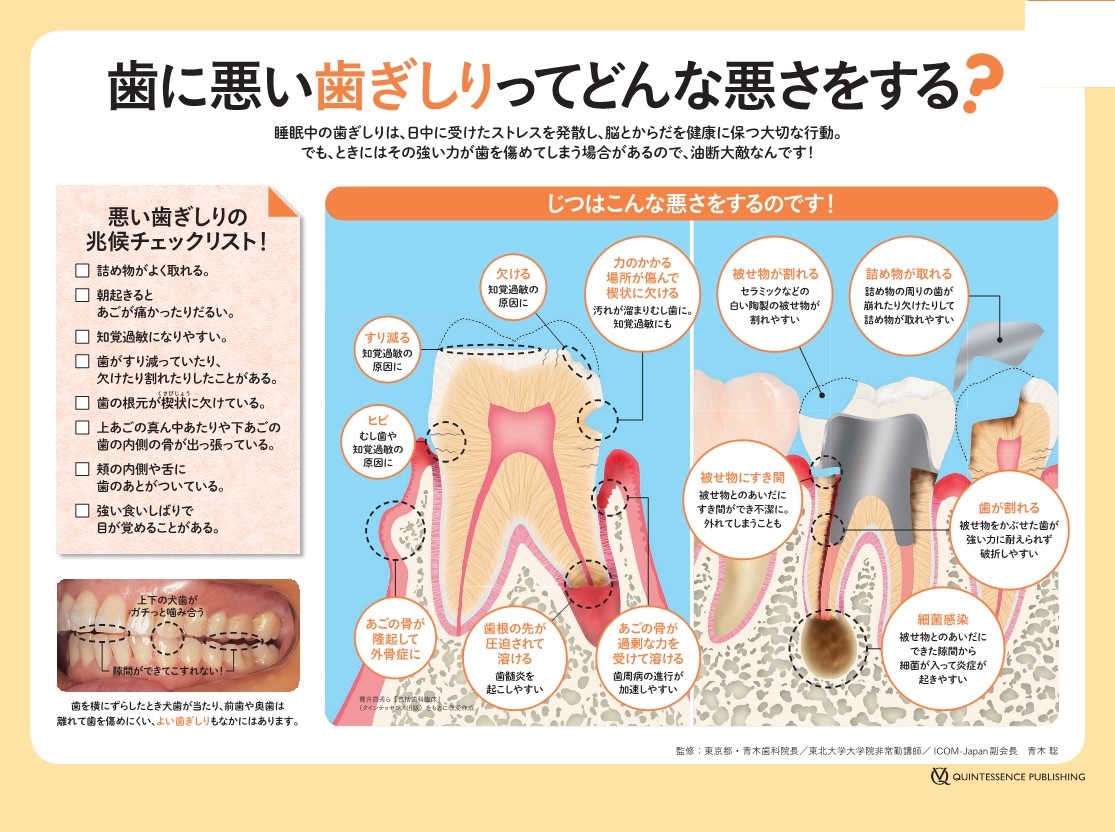 歯ぎしりしていませんか？