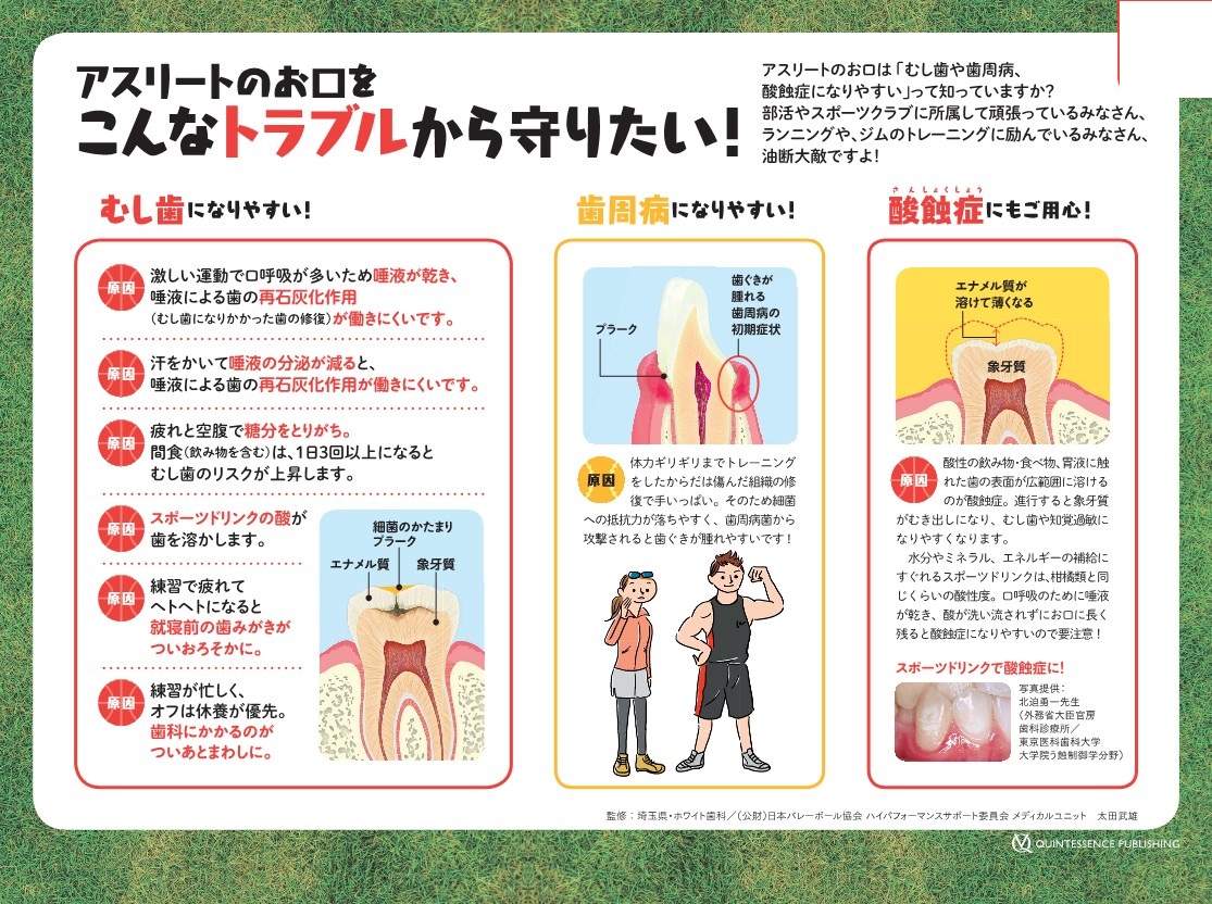 アスリートをお口のトラブルから守ろう