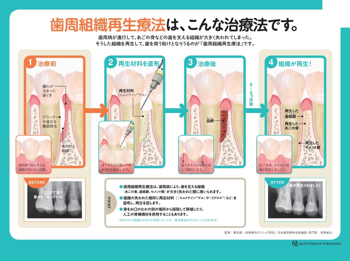 再生療法とは？