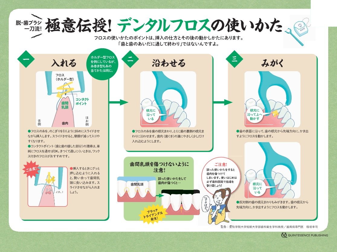 デンタルフロス、歯間ブラシの使い方