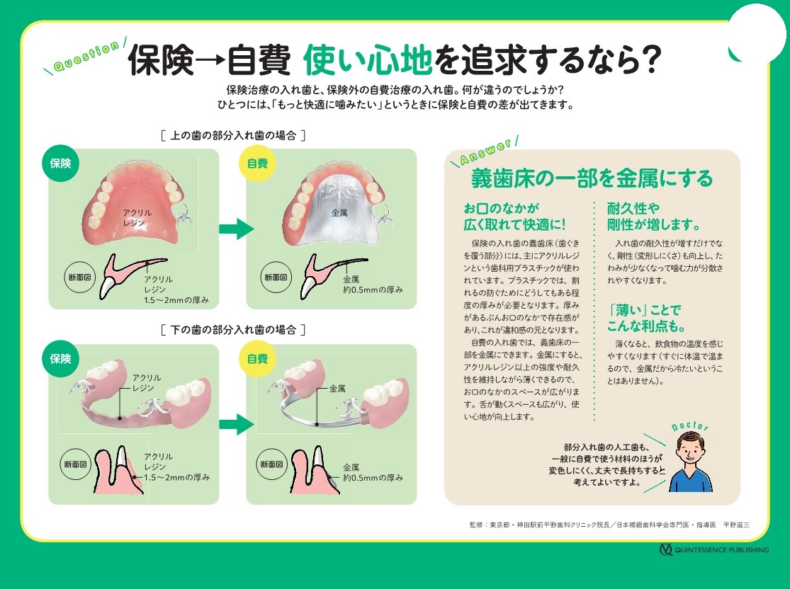 自費の入れ歯と保険の入れ歯の違い