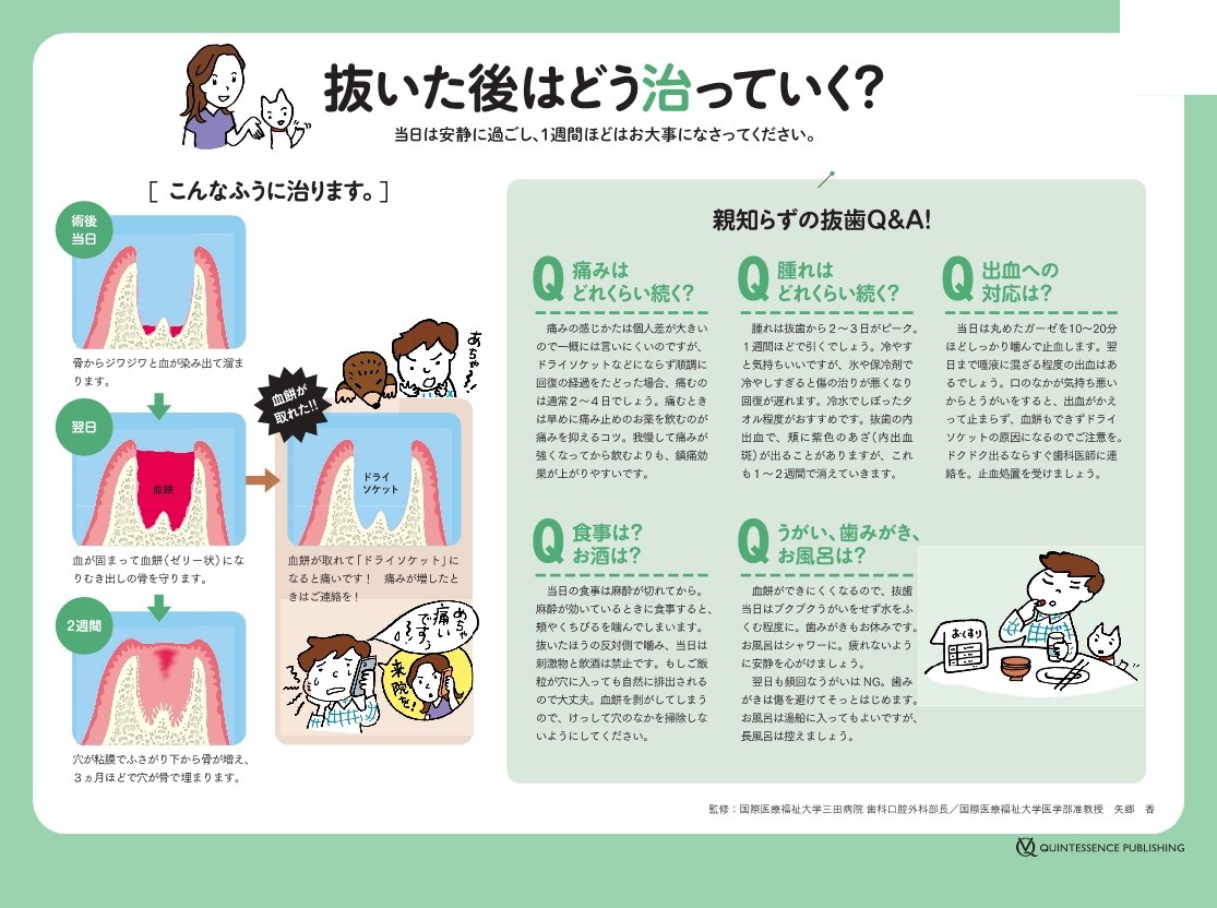 親知らずを抜いた時の注意事項