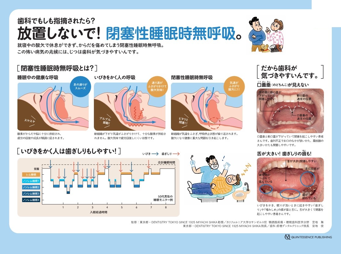 閉塞性睡眠時無呼吸症候群について